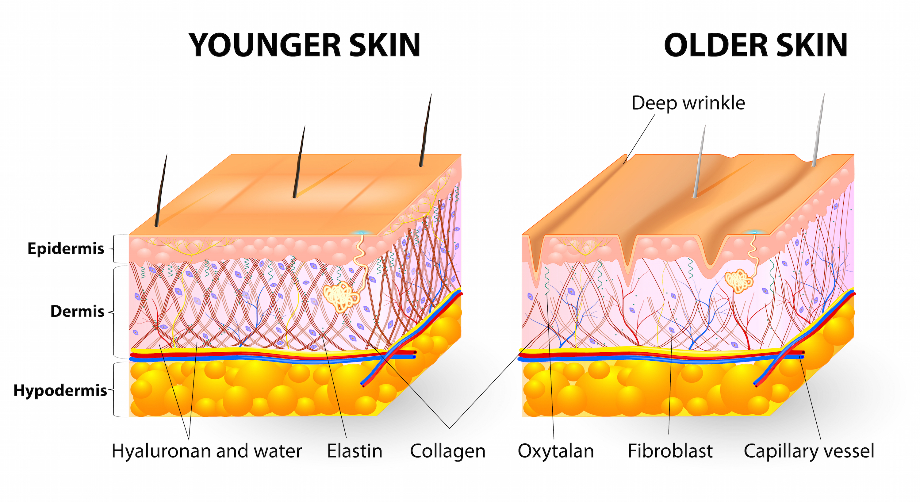 Collagen thông thường khác với Collagen thủy phân