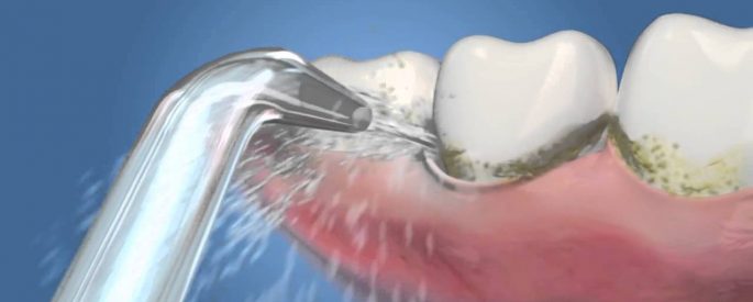 cách vệ sinh răng miệng hiệu quả